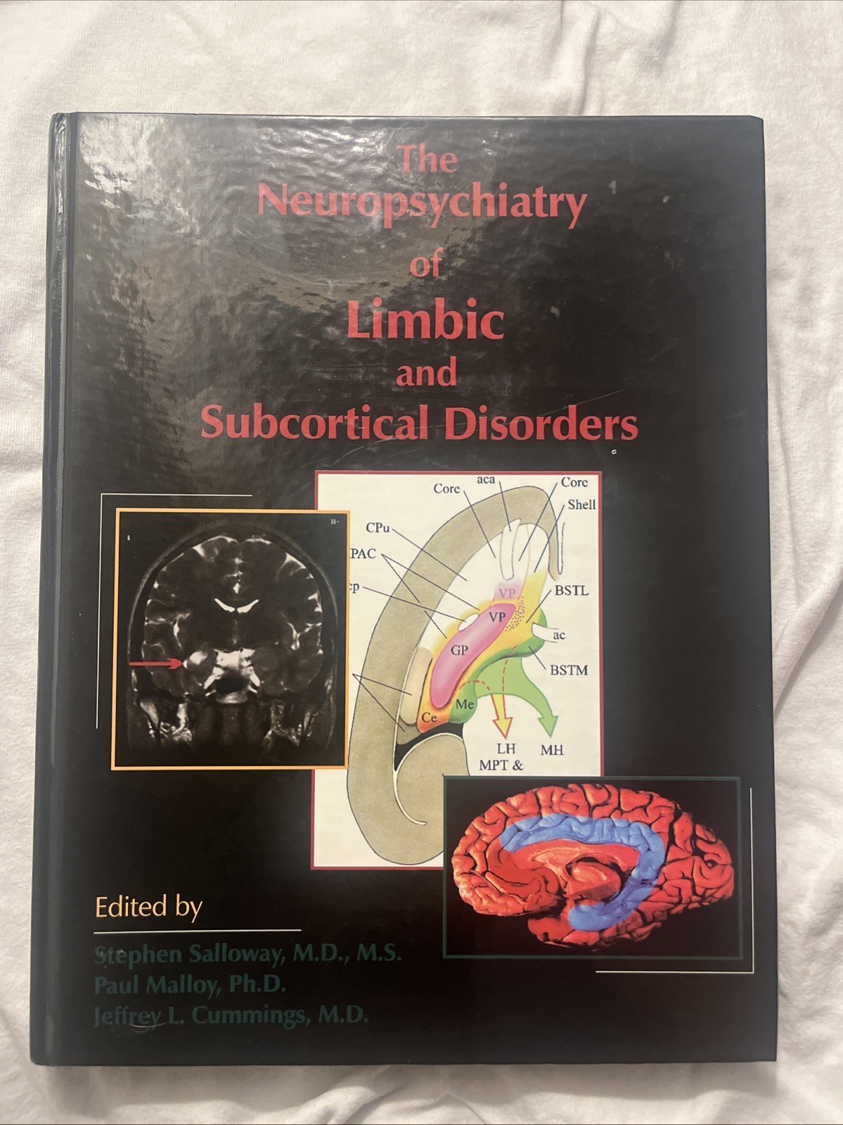 Neuropsychiatry of Limbic and Subcortical Disorders by Paul Malloy and...