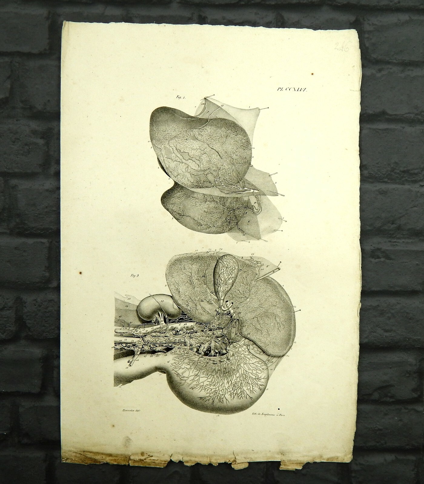 4 x Antique 1828 & 1837 Anatomical Original Georgian Victorian Medical Plates