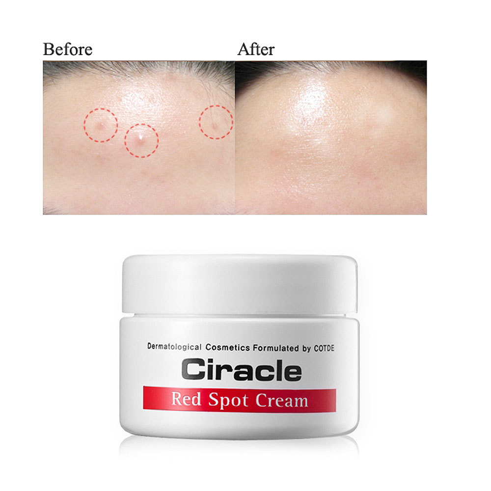 [Ciracle] Red Spot Healing Cream 30ml Trouble skin Pimple Acne Anti-blemish  