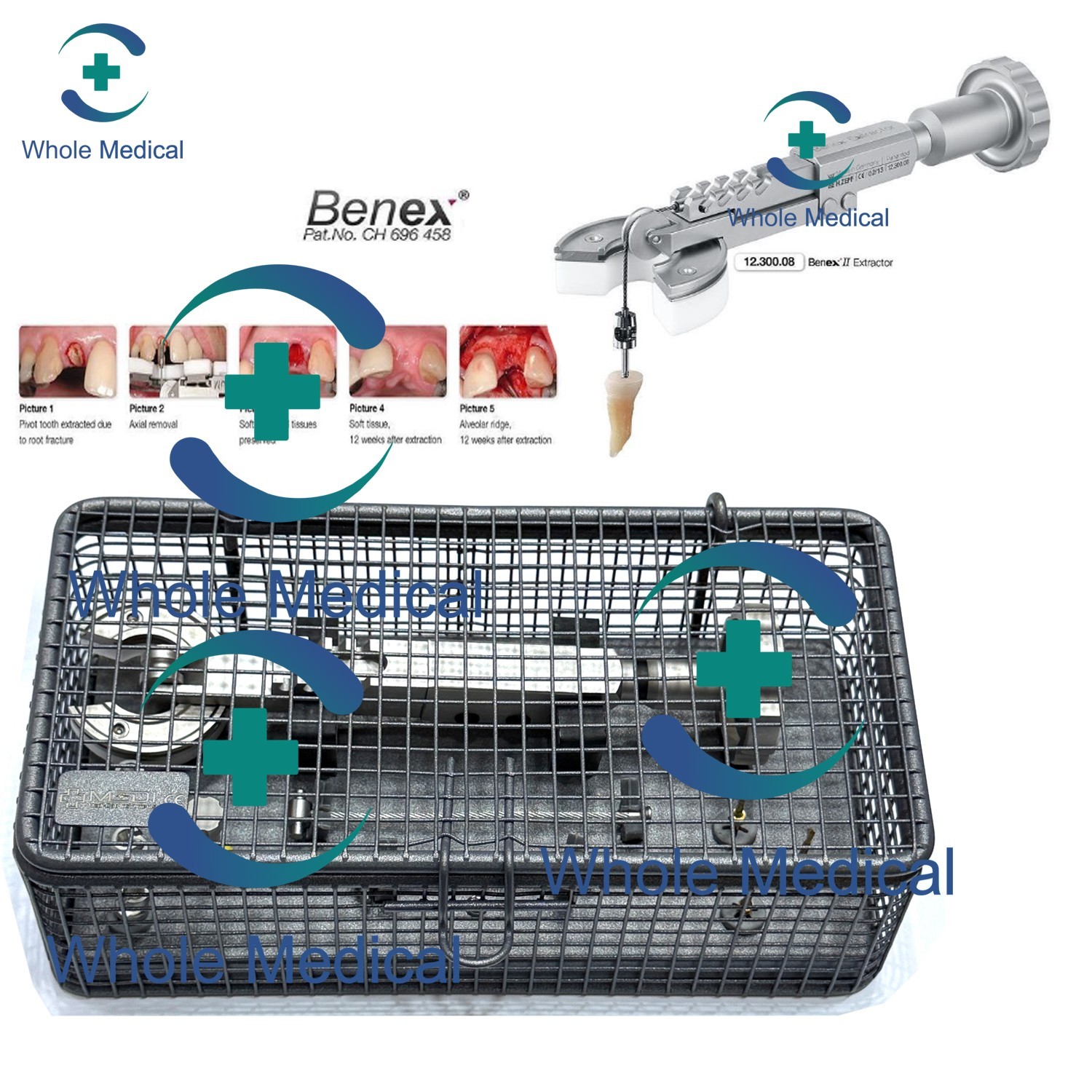 BENEX II Tooth Extraction System Root Extractor Instrument Kit Dental Surgical BENEX II Tooth Extraction System Root Extractor Instrument Kit Dental Surgical