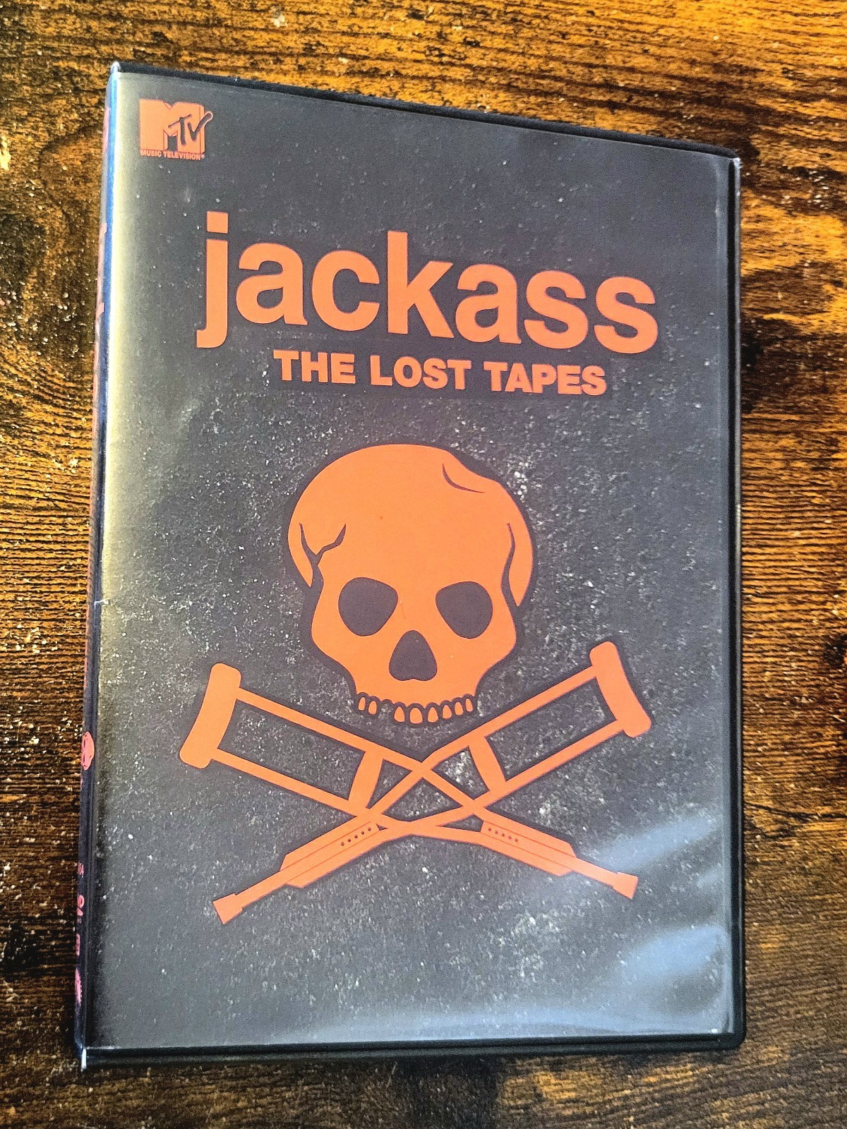 Jackass: The Lost Tapes DVD Set (Johnny Knoxville, Steve-O)