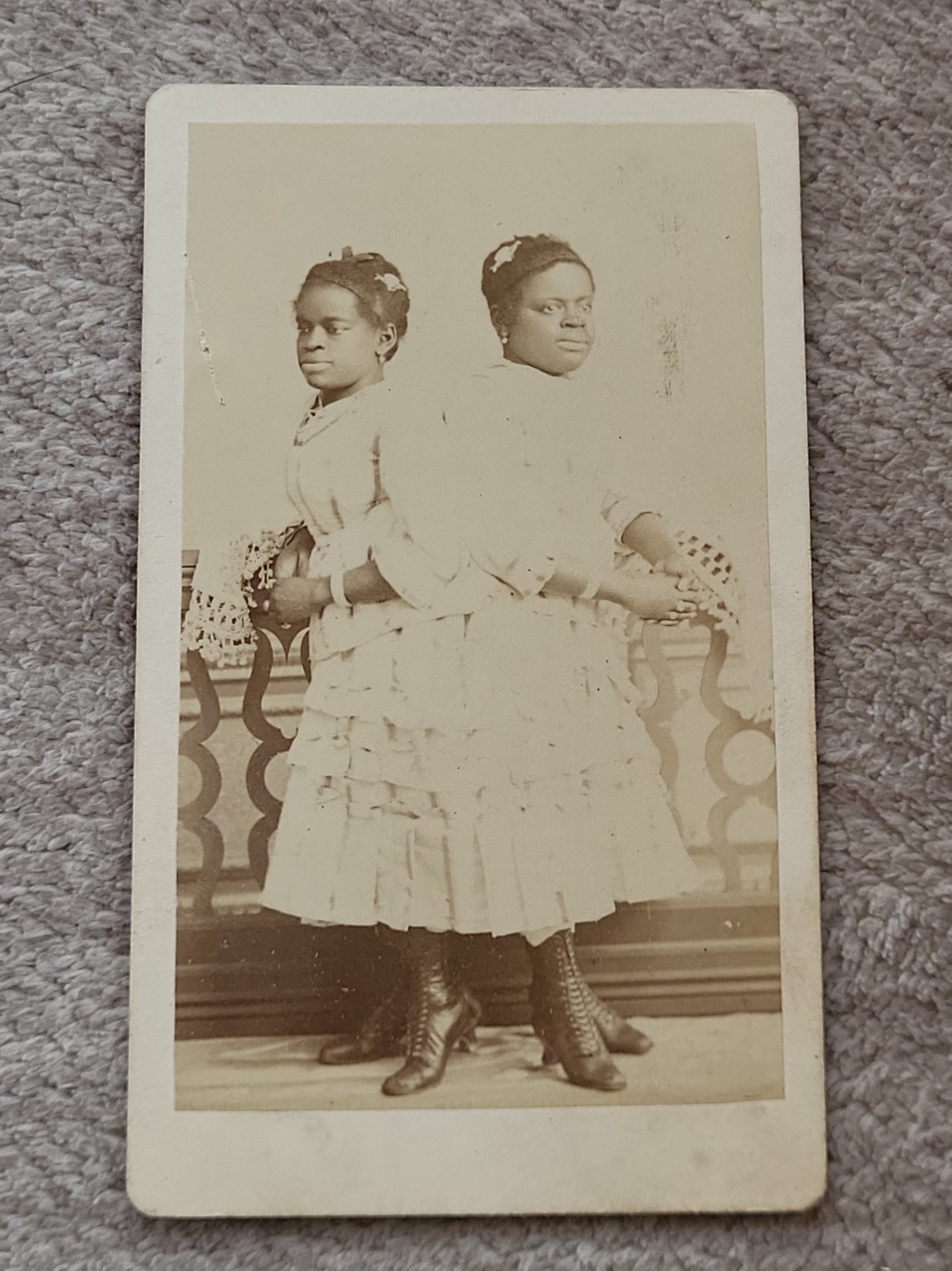 RARE 1870s CDV Photo Millie Christine McKoy Two-Headed Nightingale Sideshow