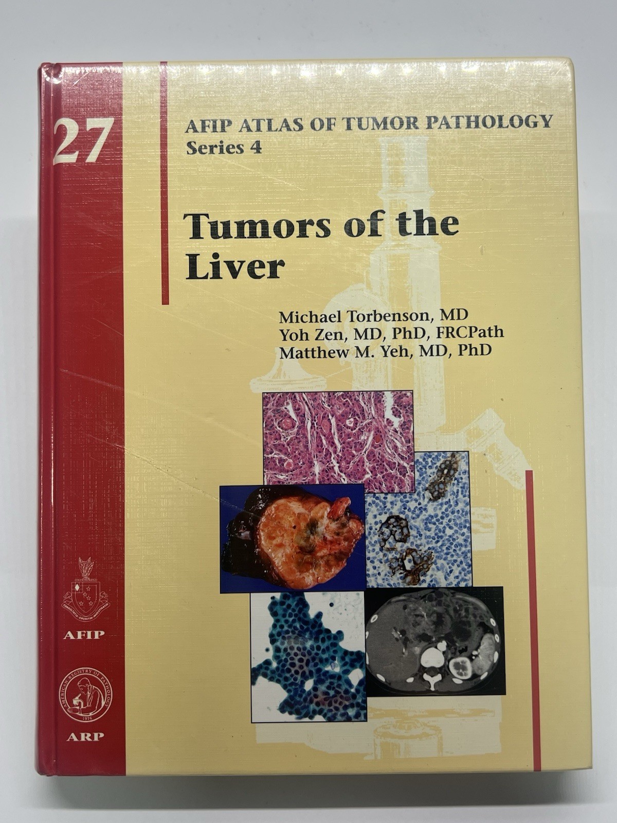 Tumors of the Liver by MD Torbenson, Michael: New