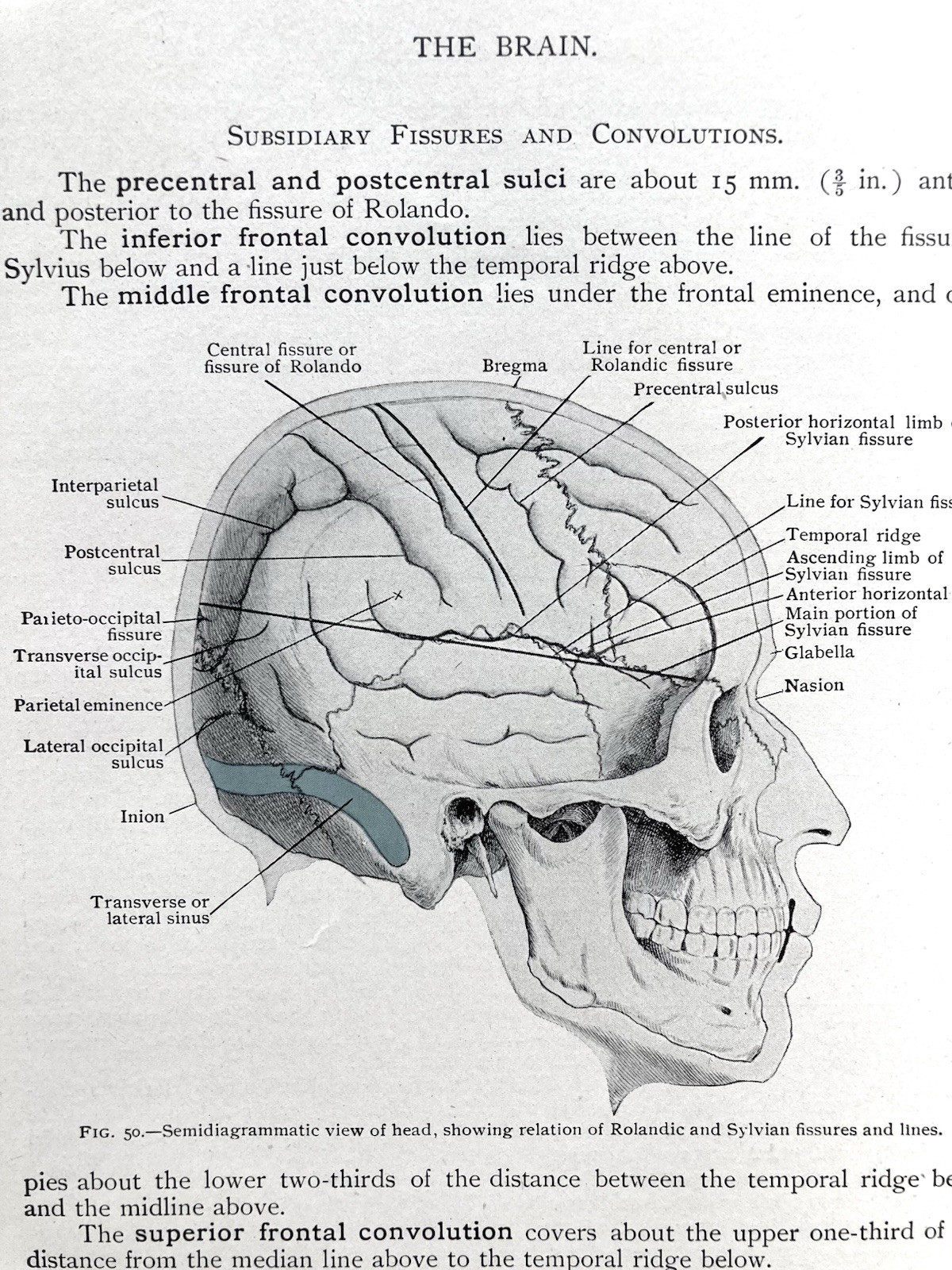 Antique, Applied Anatomy, 1918, Davis, 5th. Ed., 600+ Illustrations, Good+ Cond.