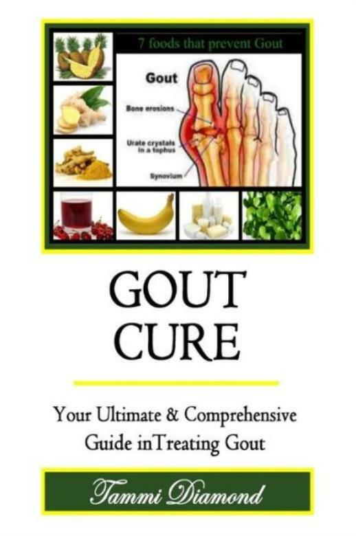 Gout Cure: Your Ultimate And Comprehensive Guide In Treating Gout
