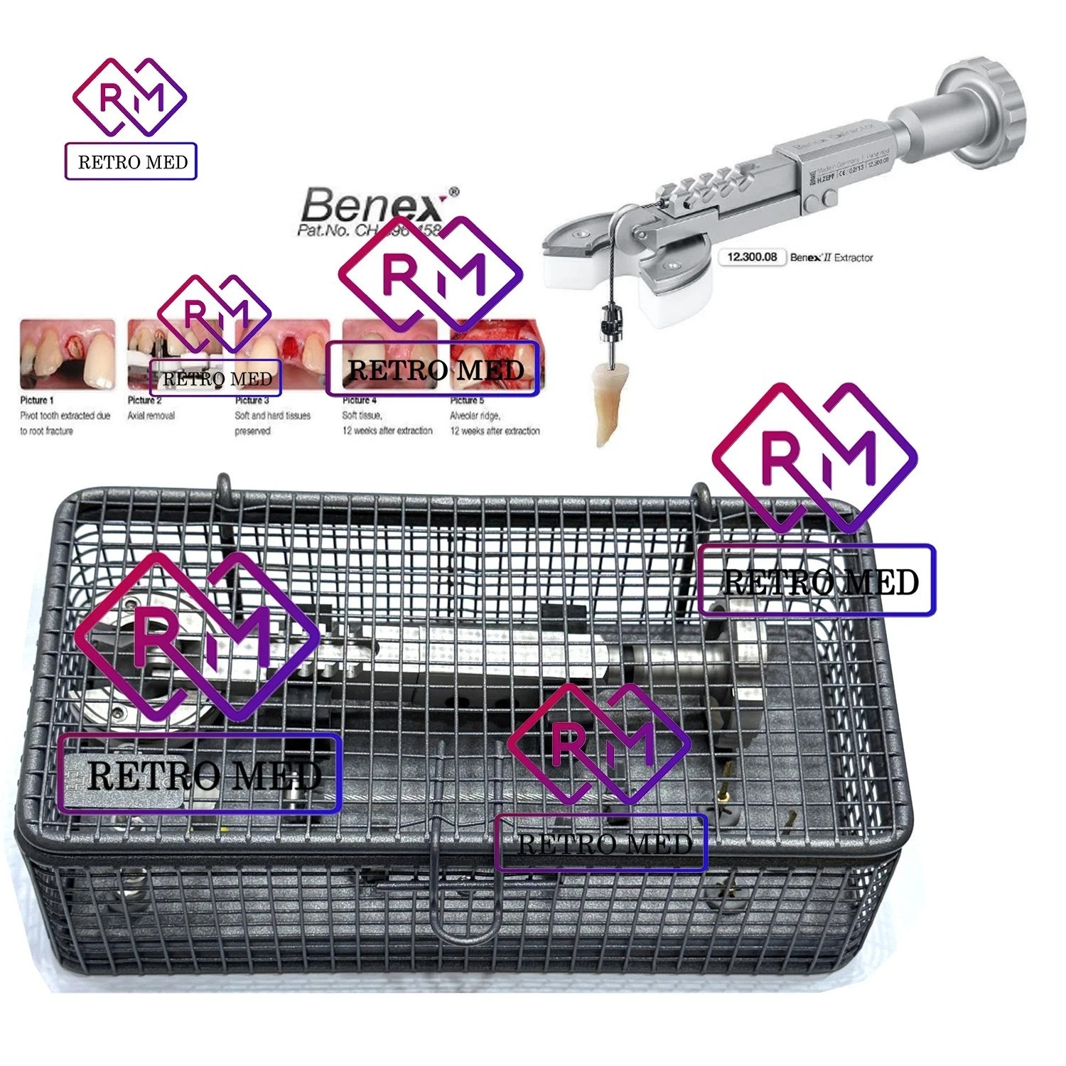BENEX II Dental Extraction System Full Surgical Kit for Atraumatic Tooth Removal