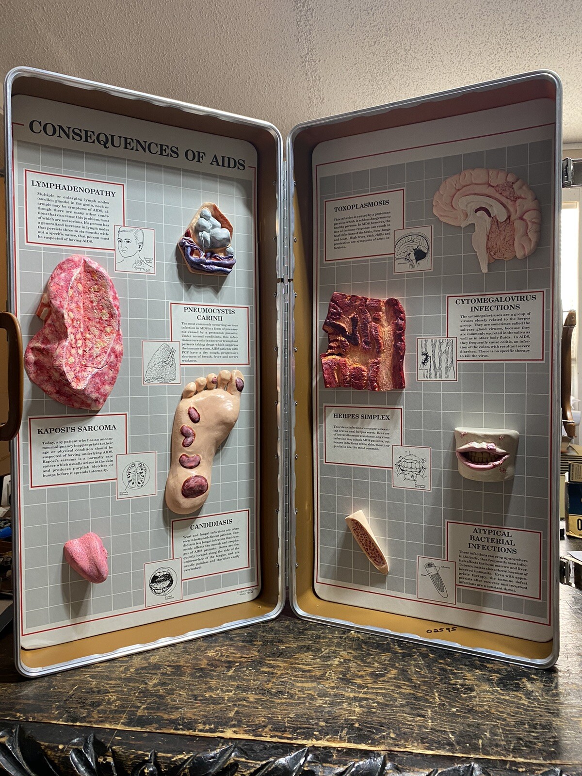 Vintage Health Edco Consequences Of AIDS Display In Case Teaching RARE Vintage Health Edco Consequences Of AIDS Display In Case Teaching RARE