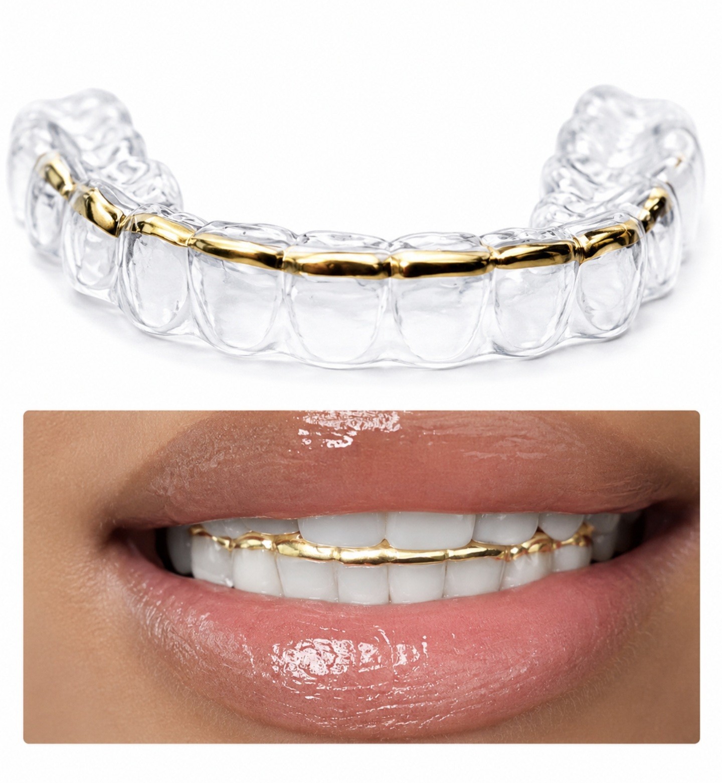 Retainer With Gold Trim, Affordable keep Teeth from shifting while turning heads