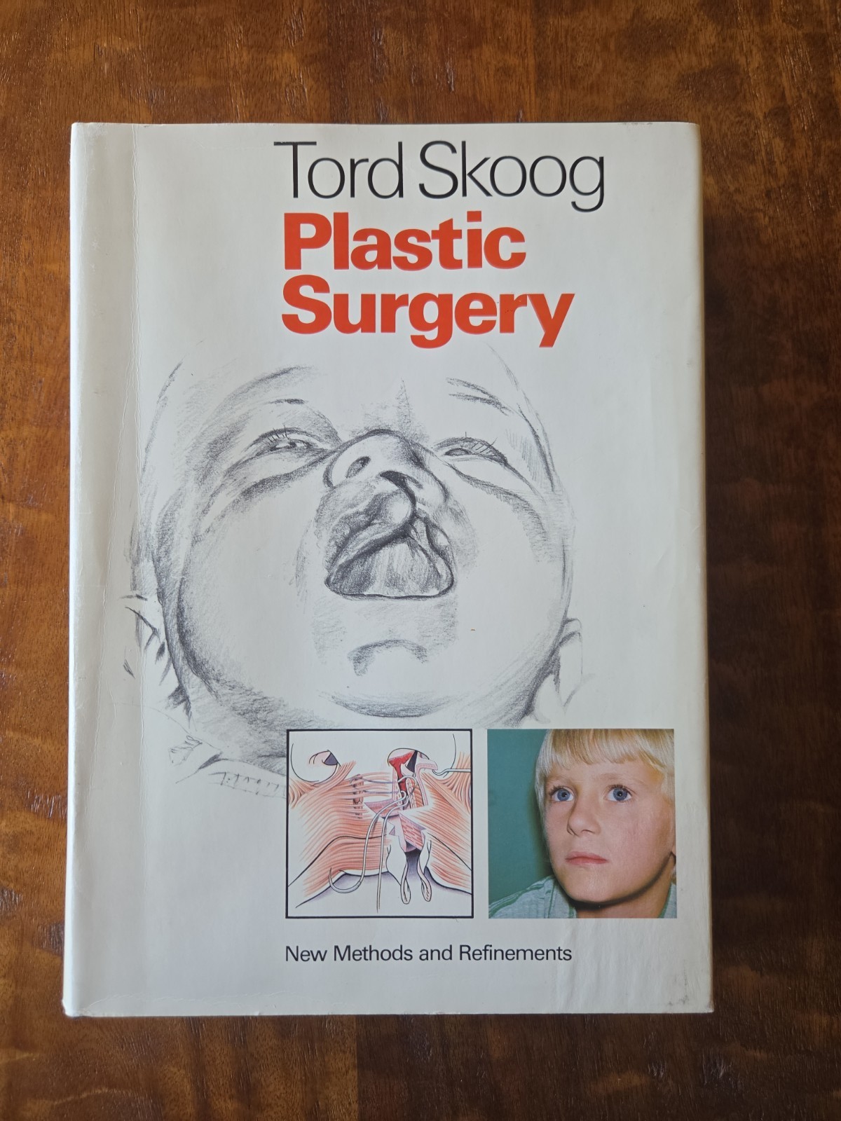 Plastic Surgery: New Methods & Refinements – Tord Skoog 1974 HC VTG Medical Book