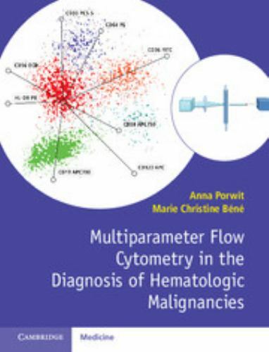Multiparameter Flow Cytometry in the Diagnosis of Hematologic Malignancies