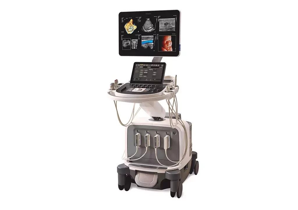 Philips Ultrasound Software - Digital Delivery
