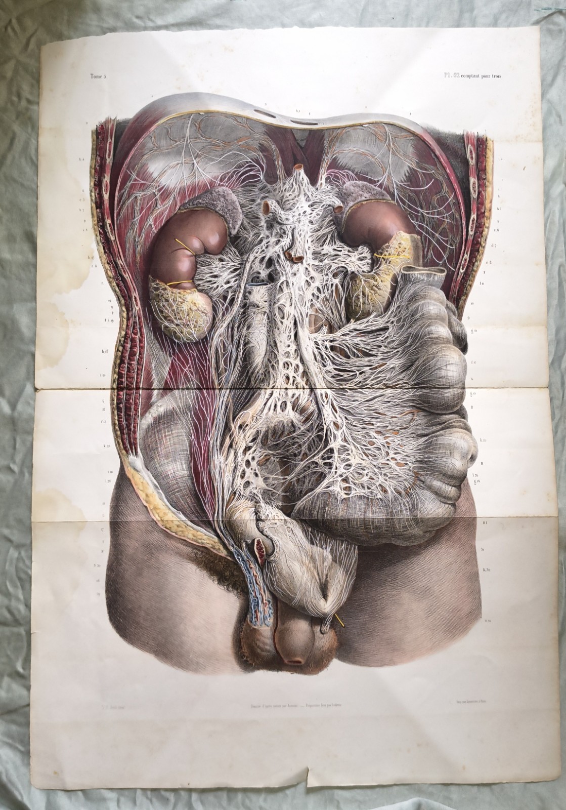 Rare 19th C Large Plate Engraving Traité complet de l'anatomie de l'homme 1836