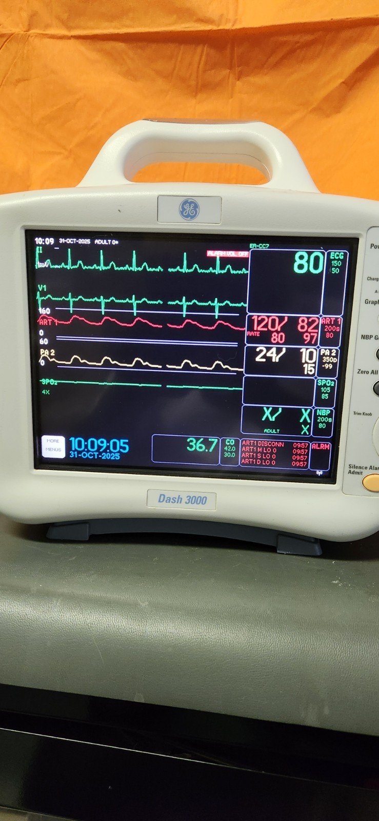 GE DASH 3000 Patient Monitor
