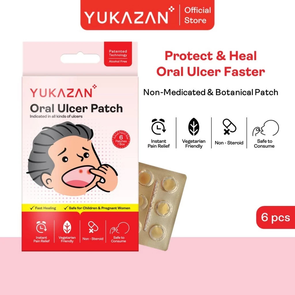 Yukazan Oral Ulcer Patch For All Kinds Of Oral Ulcers