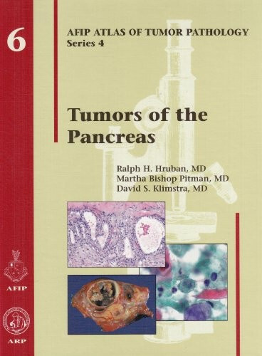 AFIP Atlas of Tumor Pathology: Fourth Ser.: Tumors of the Pancreas by American R