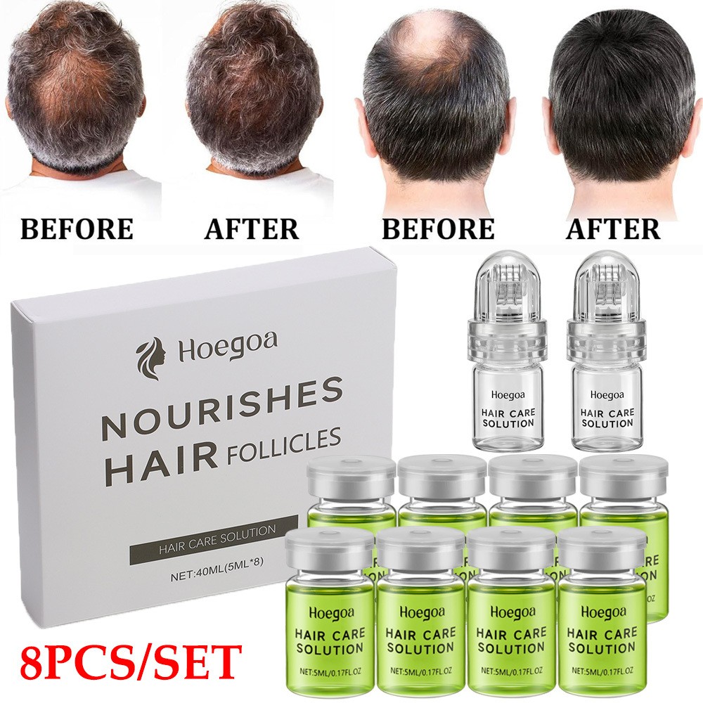 8PCS/SET Hair Regrowth System,Advanced Hair Growth Treatment for Men & Women