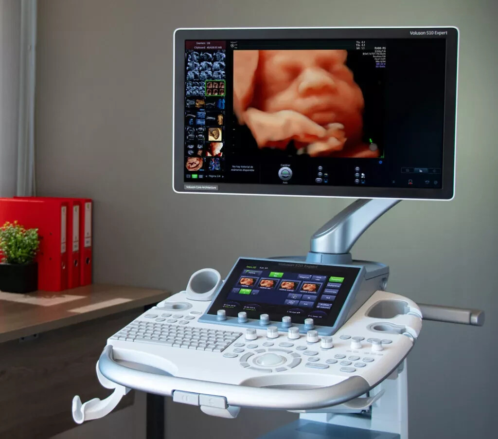 GE Ultrasound Software – Official Installation for Voluson/Logiq/Vivid Systems