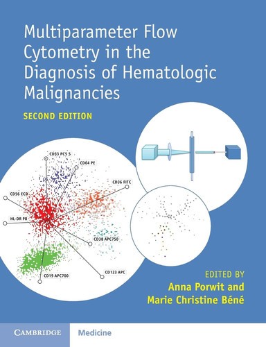 Multiparameter Flow Cytometry in the Diagnosis of Hematologic Malignancies -