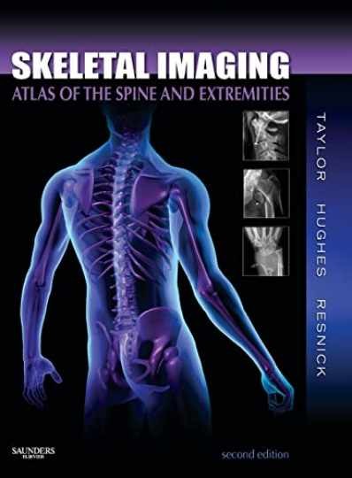 Skeletal Imaging: Atlas of the Spine and - Hardcover, by John A. M. - Very Good