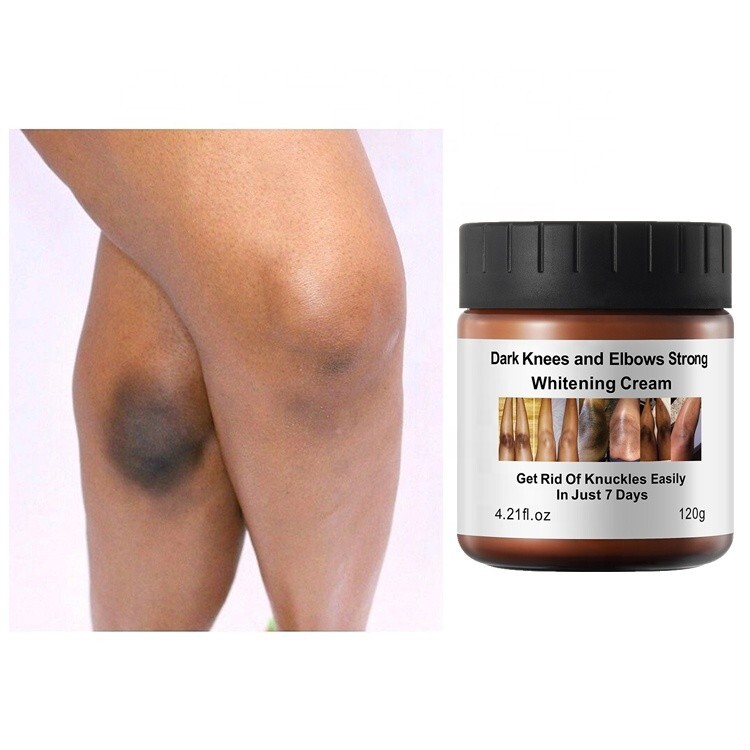 New Strong Whitening Cream For Removing Dark Knuckle Finger Elbow and Knee New Strong Whitening Cream For Removing Dark Knuckle Finger Elbow and Knee