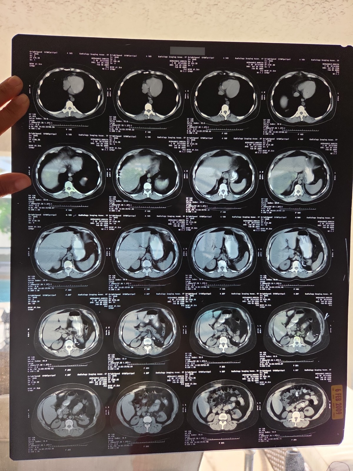 Medical X-ray Photographs Multiple Locations 