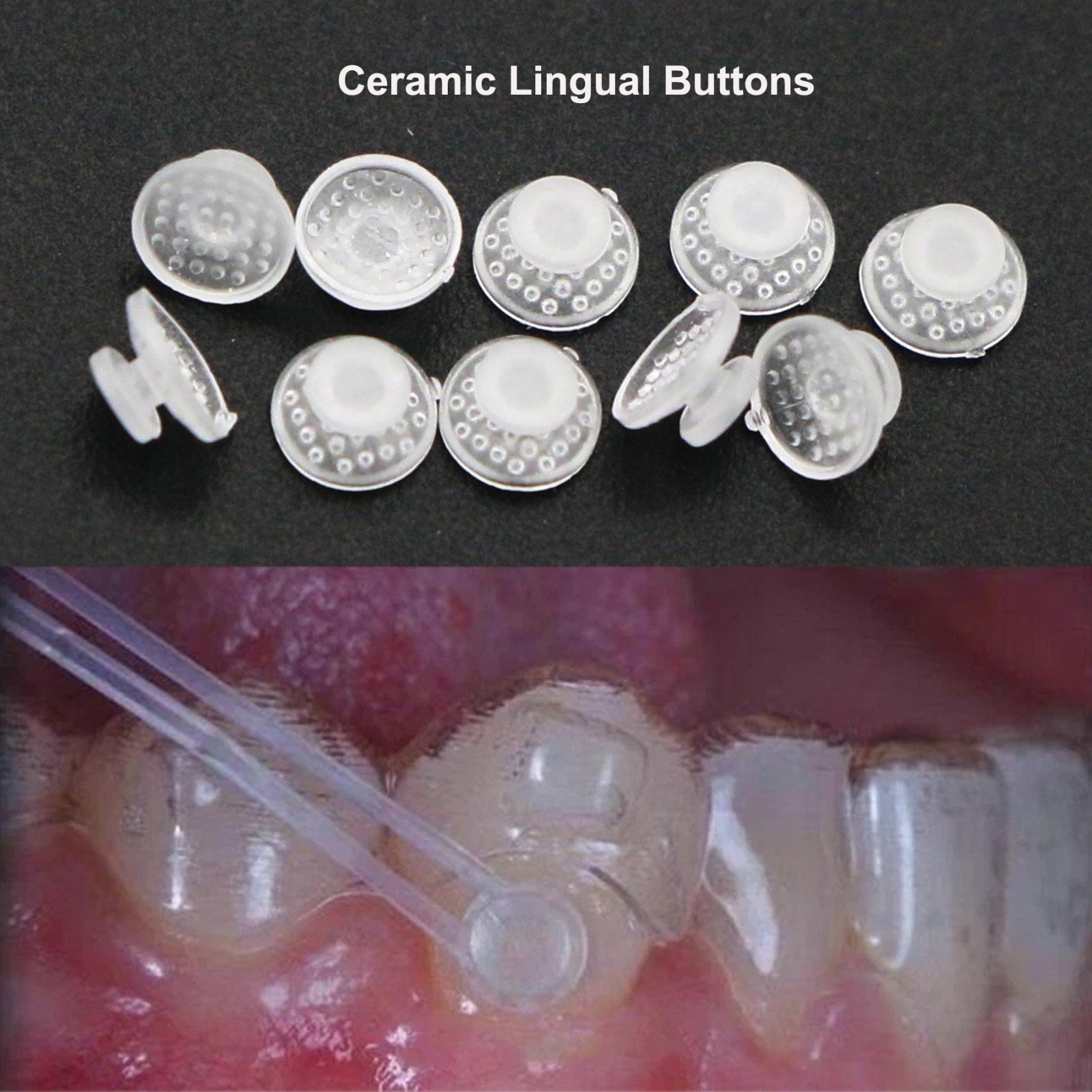 US 100Pcs Orthodontic Dental Ceramic Lingual Button Bondable Round Base Clear