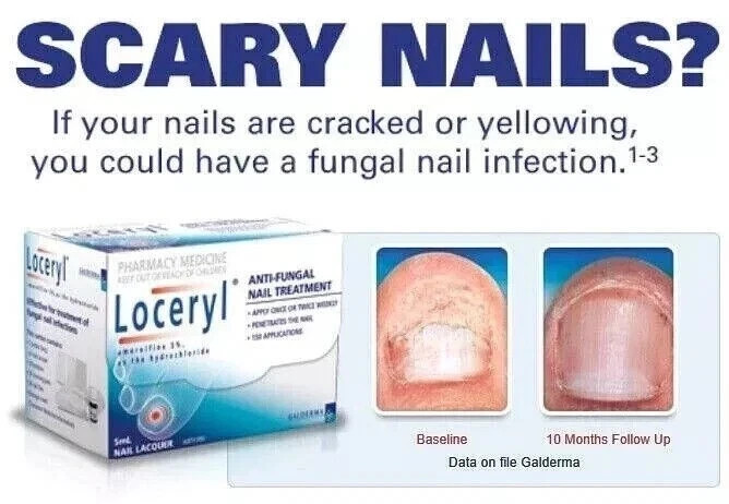 Nail Fun-gal Lacquer 2.5ML FREE & FAST DELIVERY