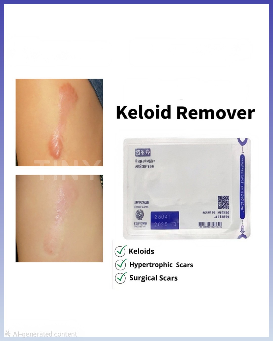 5 X sheets keloid tape Ecla  Plaster
