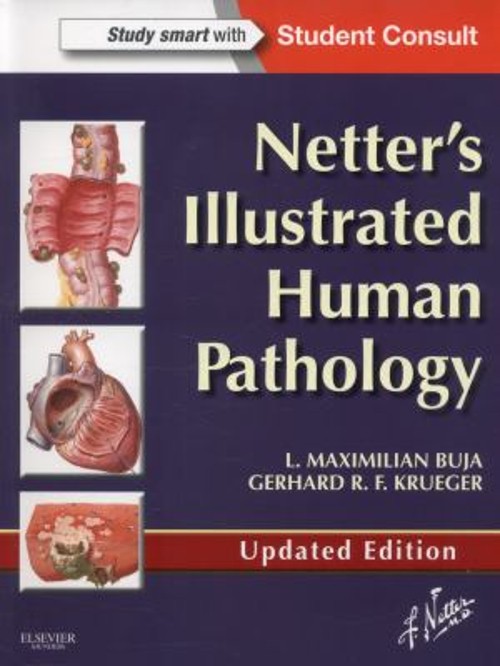 Netter\'s Illustrated Human Pathology Updated Edition : With Stude