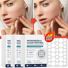 1-3BOX Microneedle Patches 144pcs, Skin Tag Wart Acne Remover Patches ~2026 NEW picture