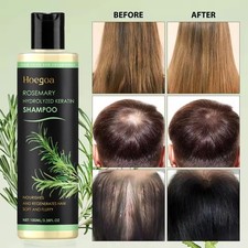 1-10x Organic Rosemary Hair Growth Shampoo for Natural Thickening &Strengthening picture