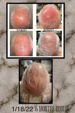 Gold Human Hair Follicle & Adipose Serum by Bradceuticals picture
