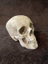 Antique Plaster Cast Of A Skull - Doctor’s Office Kept - Real Skull Casting picture