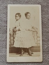 1870s CDV Photo McKoy Black Twins Two-Headed  Nightingale Sideshow Circus Freak picture