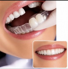 Retainer With Teeth, Affordable Way To Fill In Your Smile, can add 1-4 Teeth.   picture