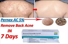 Benzoyl Peroxide Gel for remove back Acne & black spots 20 gm pack of 2 picture