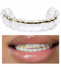 Retainer With Gold Trim, Affordable keep Teeth from shifting while turning heads picture
