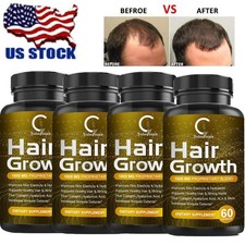 1-4PCS DHT BLOCKER HERBAL HAIR FAST GROWTH PILLS PREVENT ANTI LOSS STIMULATE picture