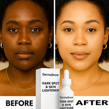 Derma Snow Whitening Face & Body Cream – Extra Strength Brightening Formula picture