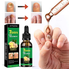 7 Days Nail Fungus Treatment – Extra Strength Repair for Nails & Cuticles 30ML picture