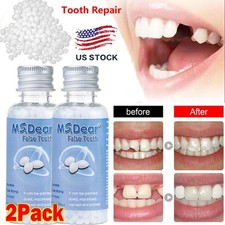 2X Tooth Repair Kit - Temporary Teeth Replacement Kit for Missing & Broken Teeth picture