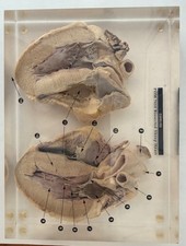 Vintage Carolina Biological Plastomount Dissected Sheep Heart (POM 7610) picture