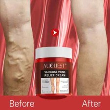 Varicose Veins Relief Cream Relieve Tired Legs Spider Pain Tighten Smooth Skin picture