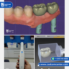 Medit i700 + SIRONA CEREC MCXL  + Ivoclar CS Oven - Chairside System picture