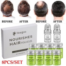 8PCS/SET Hair Regrowth System,Advanced Hair Growth Treatment for Men & Women picture