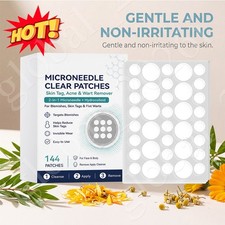 Curalona Microneedle Patches 144pcs, Skin Tag Wart Acne Remover Patches ~20% OFF picture