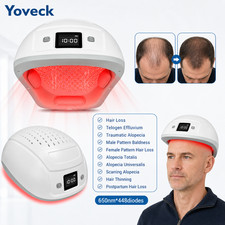 448 Diodes 650nm Laser Cap for Hair Growth Thinning Hair Telogen Effluvium Care picture