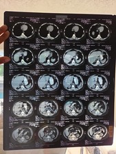 Medical X-ray Photographs Multiple Locations  picture
