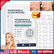 1/2X Curalona Microneedle Patches 144pcs, Skin Tag Wart Acne Remover Patches ~ picture