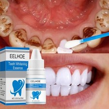Teeth Whitening Essence Remove Stains Plaque Dental Cleaning Oral Hygiene picture